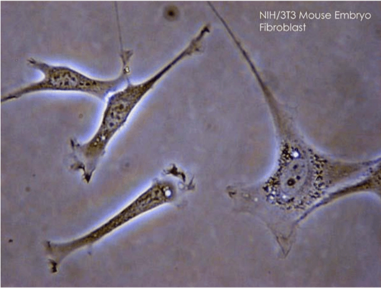 Fibroblasty – sekretem regeneracji skóry! Nowe spojrzenie na odmłodzenie i leczenie blizn