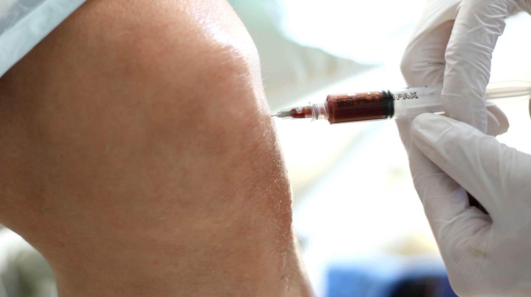 Zastosowanie fibryny bogatopłytkowej w leczeniu zmian zwyrodnieniowych łąkotki przyśrodkowej oraz chonodromalacji III stopnia stawu kolanowego_keymed-dr-szymoniak-osipowicz