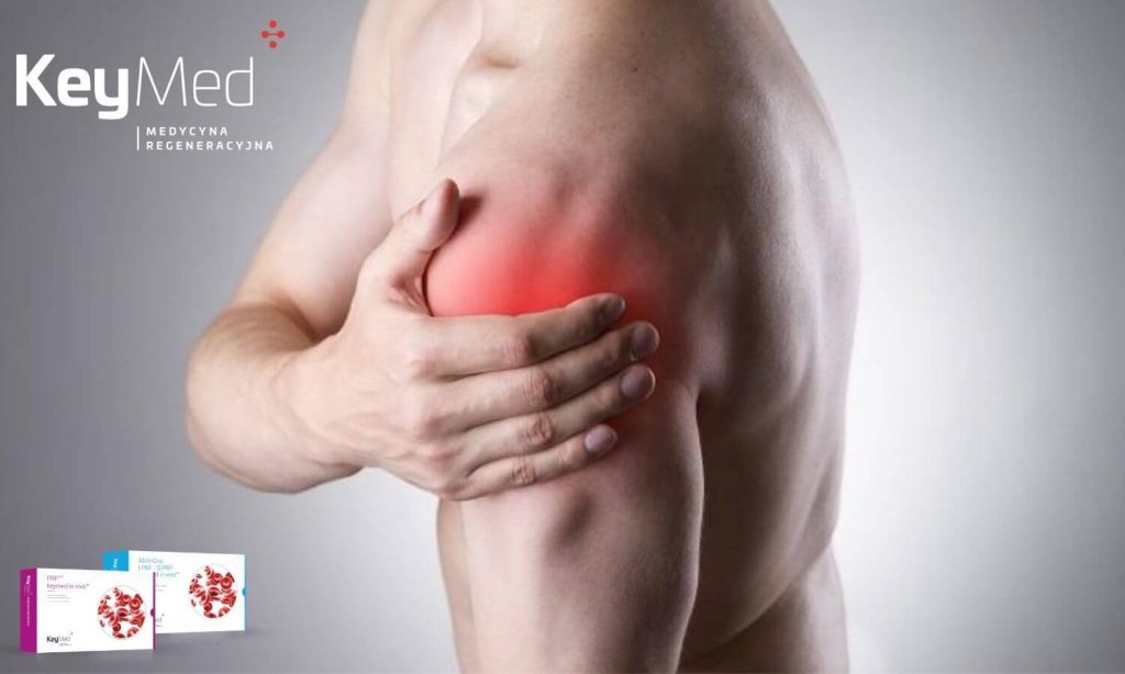 KEYMED Medyczne zestawy do osocza i fibryny w ortopedii