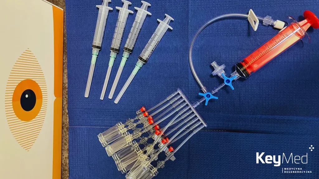 Autologiczne krople do oczu – czyli krople z krwi własnej pacjenta